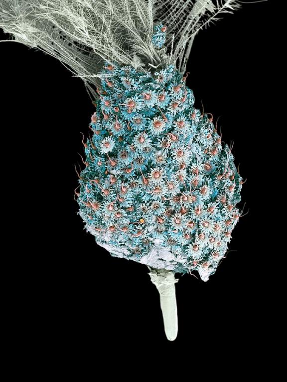 2-chicken-body-louse-eggs-sem-steve-gschmeissner