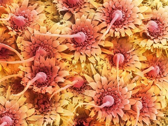 3-chicken-body-louse-eggs-sem-steve-gschmeissner